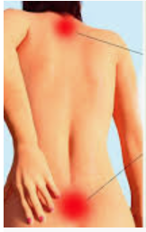 Sciatica back pain in a woman 