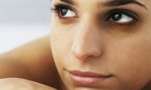 Black Circles Under Eyes